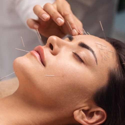 Akupunktur im Gesicht