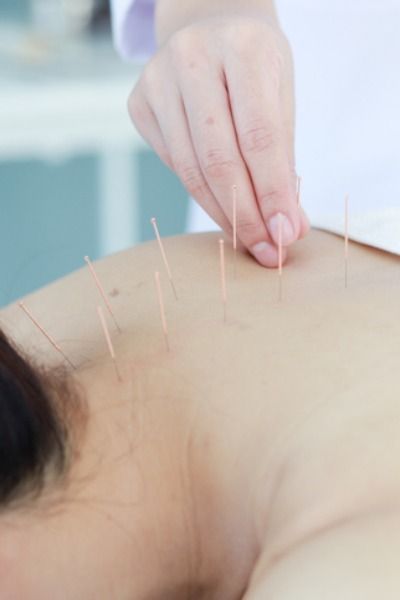 Akupunktur-Anwendung für Wangen im Allgäu