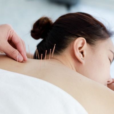 Akupunktur im Nackenbereich